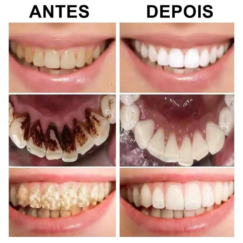 Easy Clean White - Clareamento Dental + BRINDE - Guará Descontos